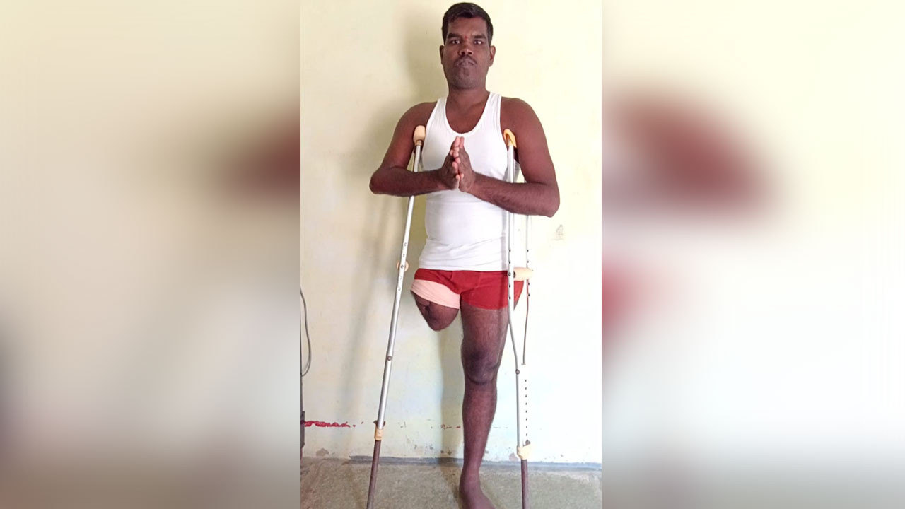 రోడ్డు ప్ర‌మాదంలో కాలును కోల్పోయిన ర‌మేశ్‌.. ఆదుకోవాలని బాధితుడి వేడుకోలు..