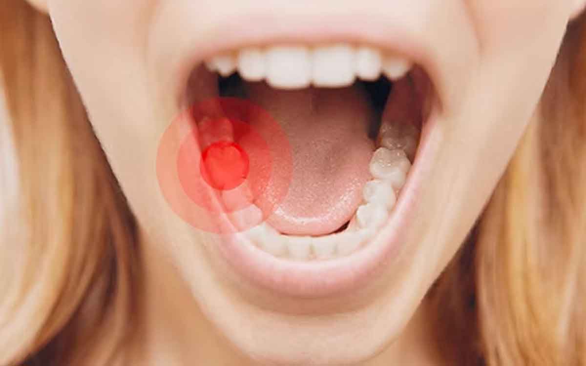 Toothache | దంతాలు, చిగుళ్ల నొప్పి తీవ్రంగా ఉందా.. అయితే ఈ ఇంటి చిట్కాల‌ను పాటించండి..!