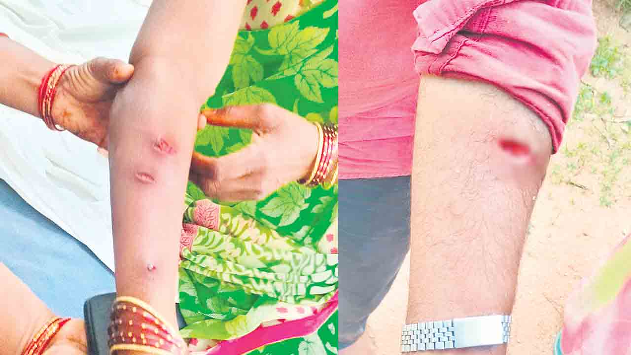 పిచ్చికుక్క స్వైర విహారం