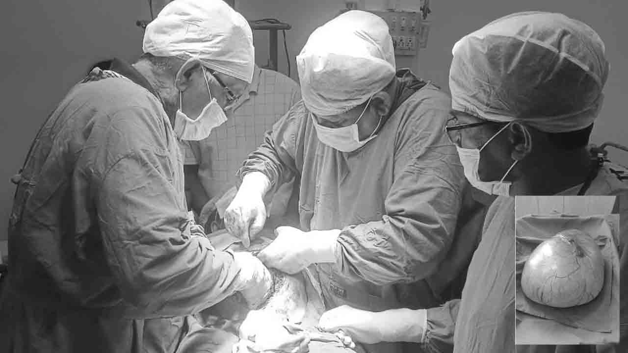 అరుదైన ఆపరేషన్‌.. యువతి కడుపులో 9 కిలోల కణితి తొలగింపు