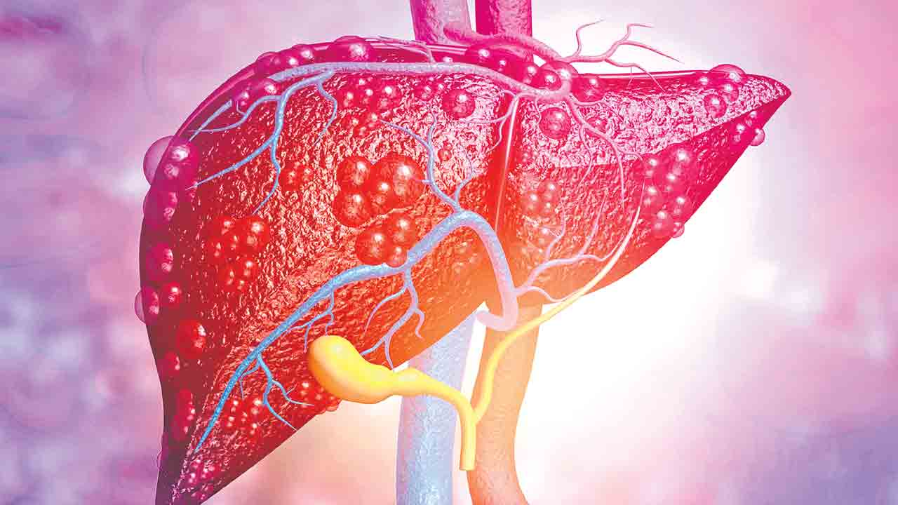 ఫ్యాటీలివర్‌.. ఎవరికైనా ముప్పే..!