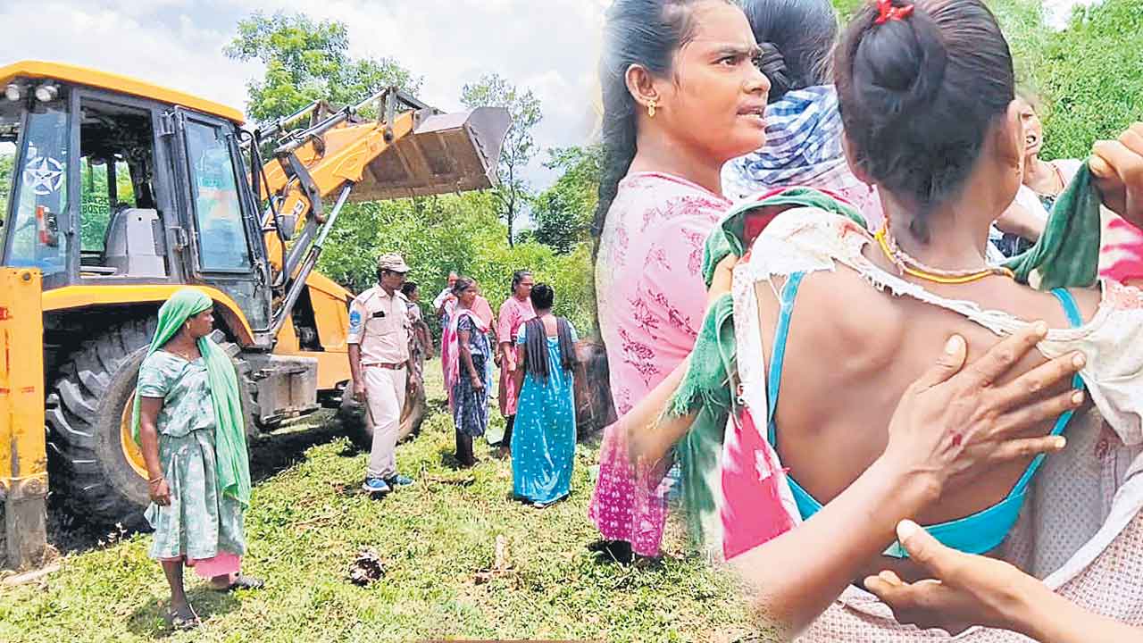 Bhadradri Kothagudem | అడవి బిడ్డలపైకి కాంగ్రెస్ బుల్డోజర్.. ఆడబిడ్డల బట్టలు చింపి, బూటు కాళ్లతో తన్ని దాష్టీకం