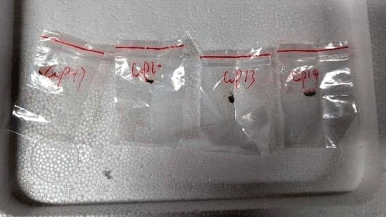 Biological Pathogen: ప్ర‌మాద‌క‌ర ఫంగ‌స్ స్మ‌గ్లింగ్‌.. అమెరికాలో ఇద్ద‌రు చైనా శాస్త్ర‌వేత్త‌లు అరెస్టు