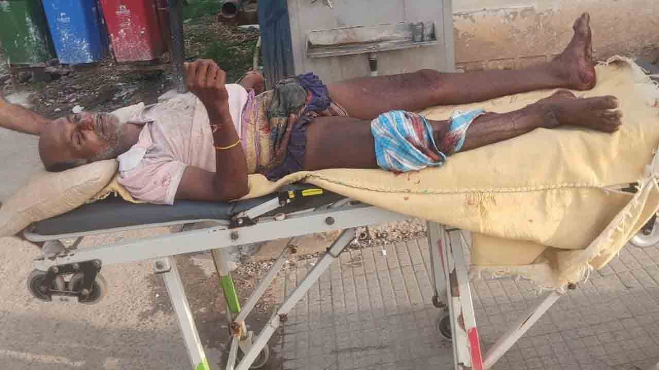 Parvathagiri | తాటిచెట్టు పైనుంచి పడిన గీత కార్మికుడు.. విరిగిన కాలు, నడుము