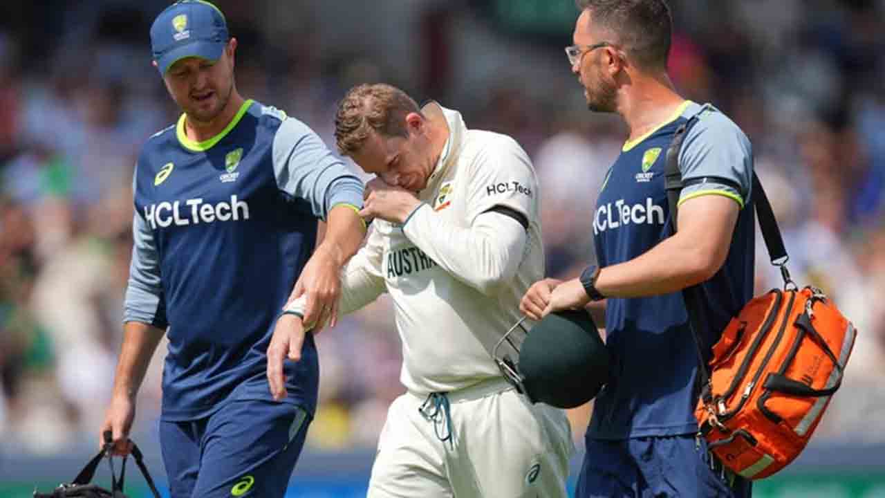 Steve Smith | అయ్యో స్మిత్.. గాయంతో ఫీల్డింగ్‌కు దూరం..!