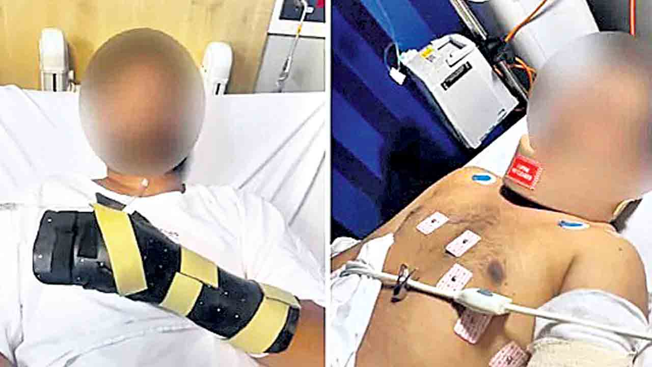 ఆస్ట్రేలియాలో మరో భారతీయుడిపై దాడి.. నలుగురు నిందితుల అరెస్ట్