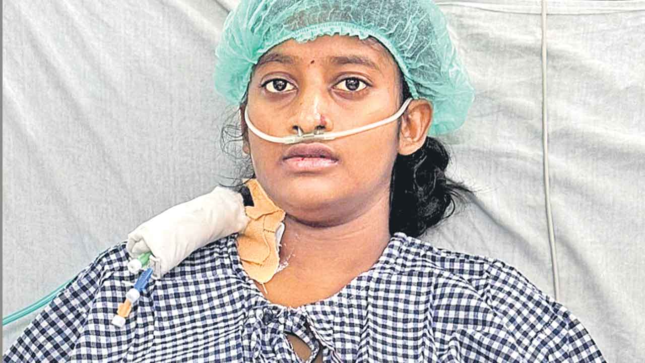 17 ఏళ్ల యువతికి ఉస్మానియా వైద్యుల పునర్జన్మ