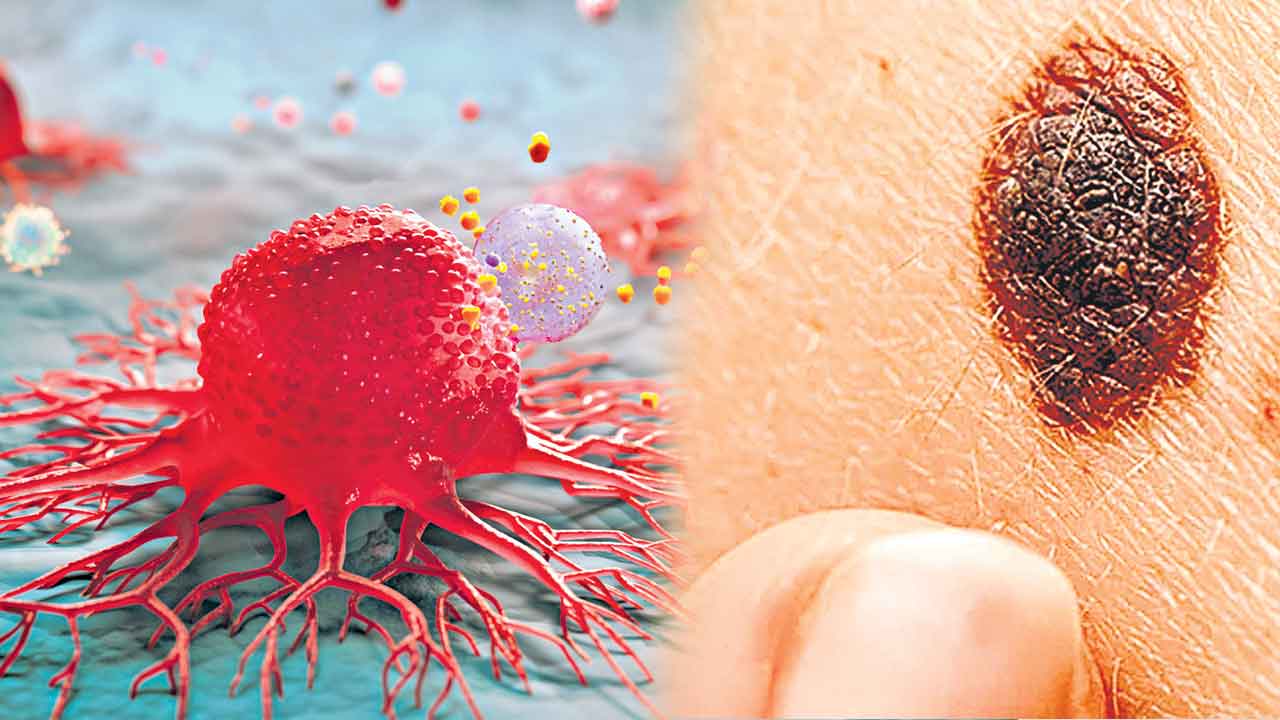 లక్షణాలు గుర్తిస్తే.. ప్రమాదం దూరం