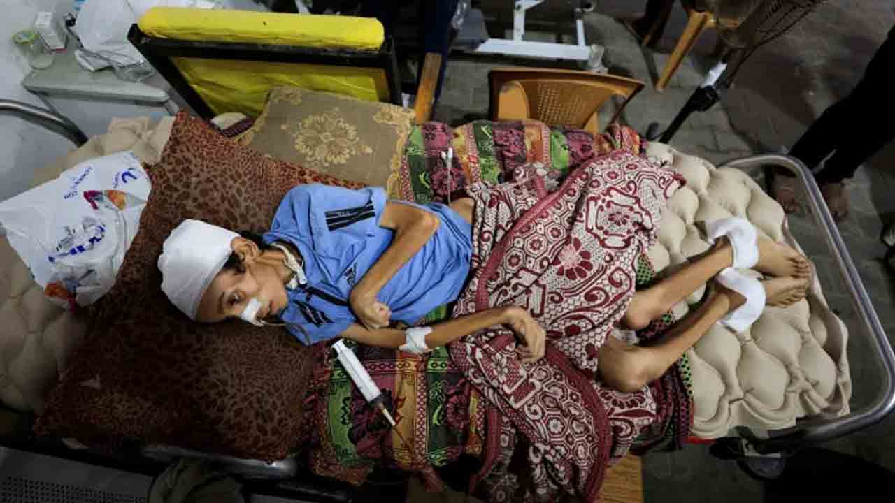 Hunger deaths | గాజాలో పెరుగుతున్న ఆకలి చావులు.. 48 గంటల్లో 20 మంది మృతి