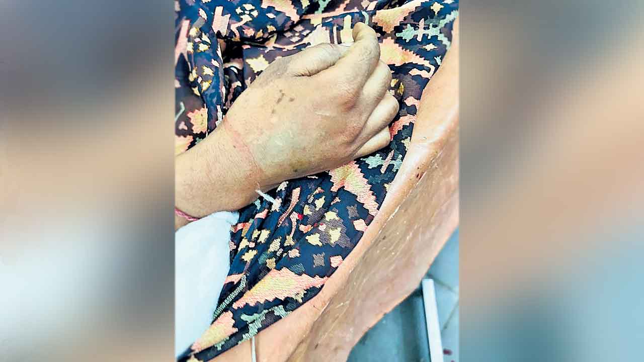 గడ్డిమందు ఇచ్చి లైంగికదాడి.. హత్య!.. మహిళపై ఆర్‌ఎంపీ డాక్టర్‌ పైశాచికం