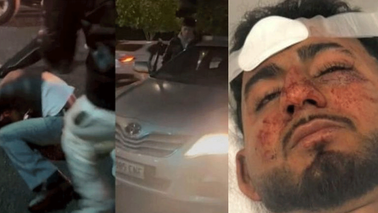 Racial Attack: ఆస్ట్రేలియాలో వ‌ర్ణ‌వివ‌క్ష‌.. భార‌తీయ విద్యార్థిపై దాడి