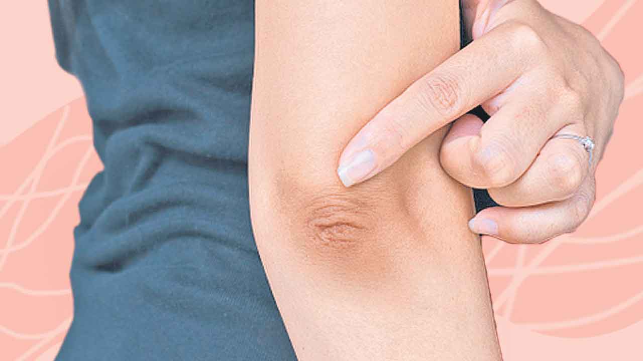 నలుపును పోగొట్టాలంటే..