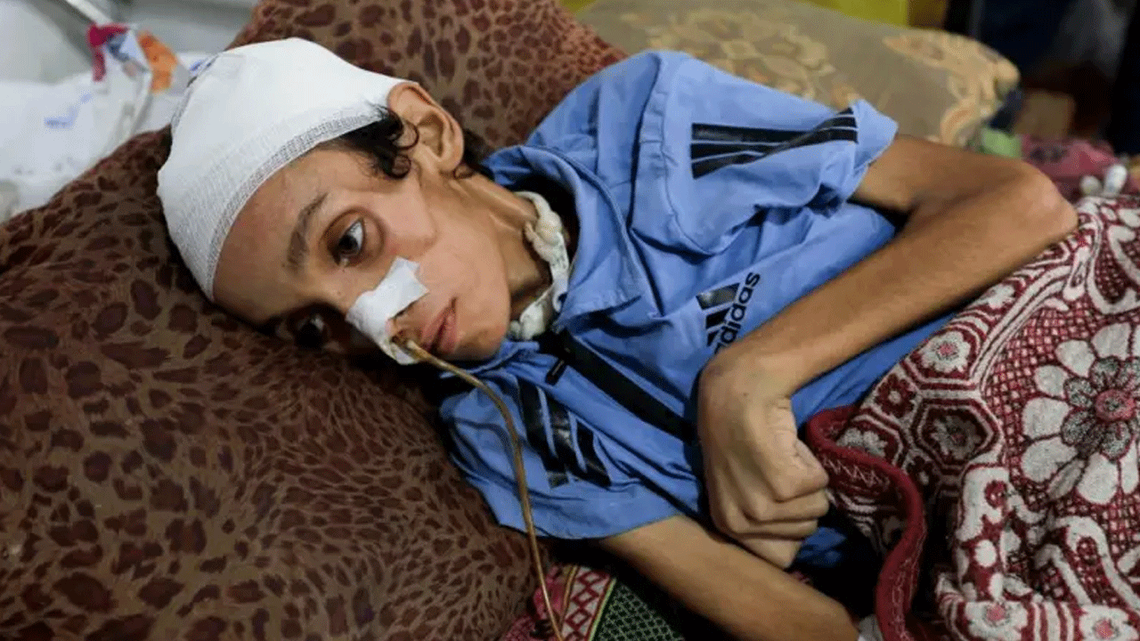 Gaza Starvation: గాజాలో తీవ్ర దుర్భిక్షం.. విస్త‌రిస్తున్న ఆక‌ల కేక‌లు