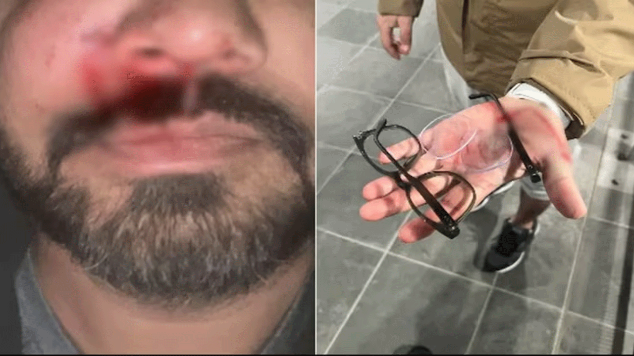 Racial Attack: ఐర్లాండ్‌లో జాత్య‌హంకార దాడి.. భార‌తీయుడిని చిత‌క‌బాదేశారు