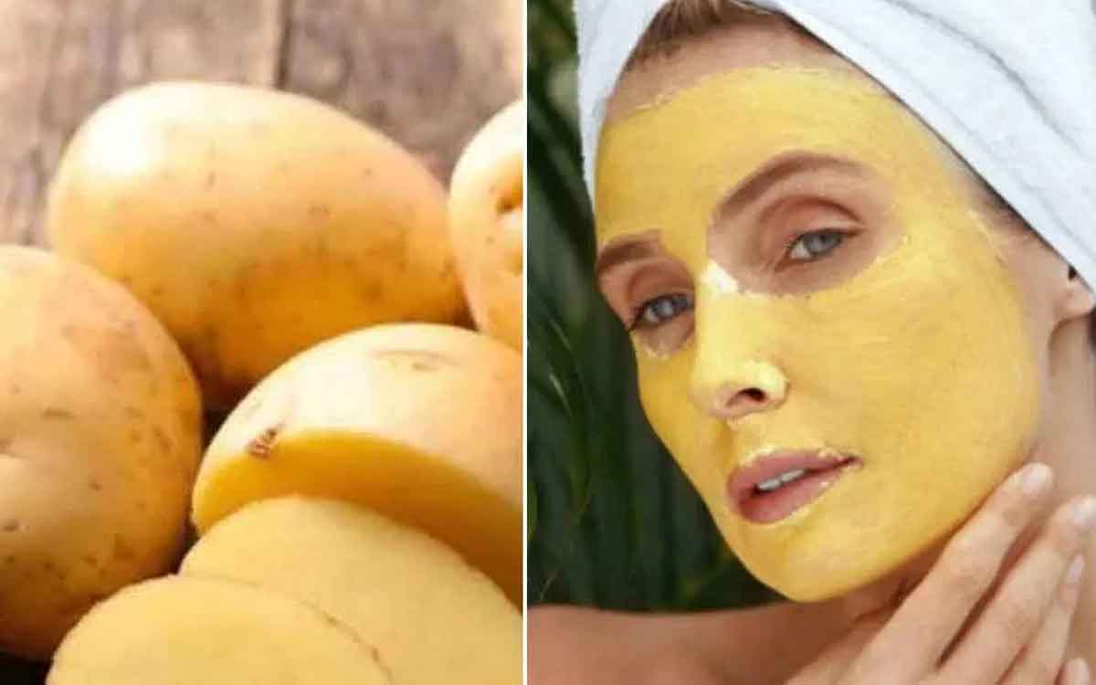 Potatoes For Skin And Hair | ఆలుగ‌డ్డ‌ల‌ను ఇలా ఉప‌యోగిస్తే మీ చ‌ర్మం, శిరోజాలు ఆరోగ్యంగా ఉంటాయి..!