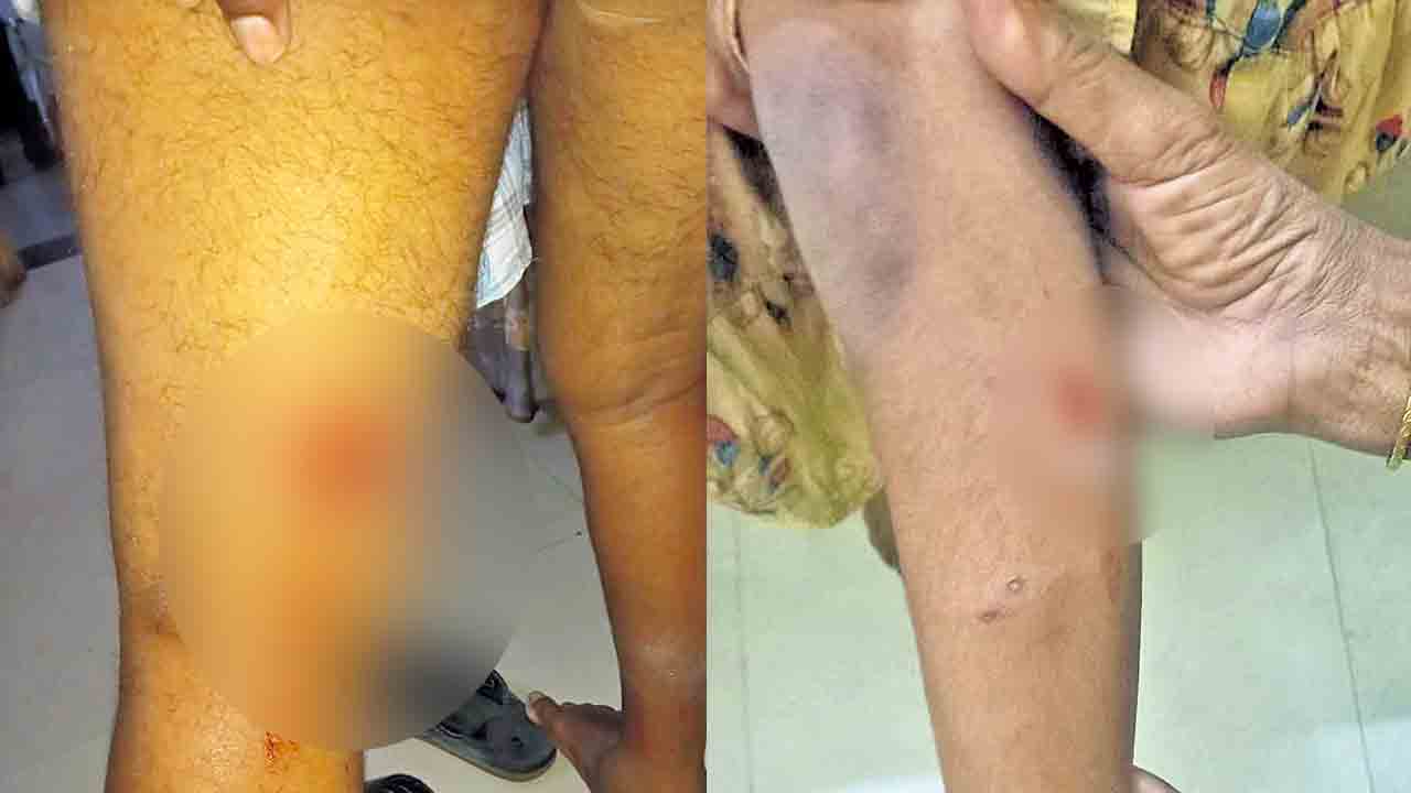 కుక్క దాడిలో 20 మందికి గాయాలు