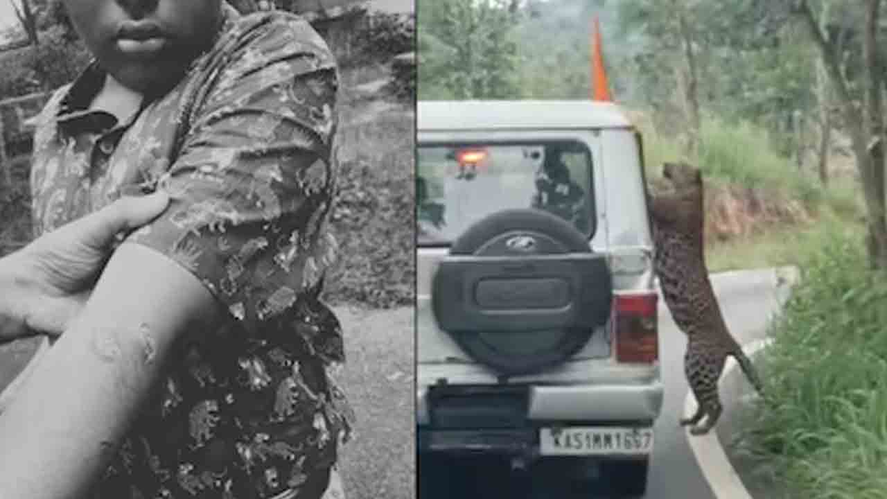 బెంగళూరు జూలో బాలుడిపై చిరుత దాడి
