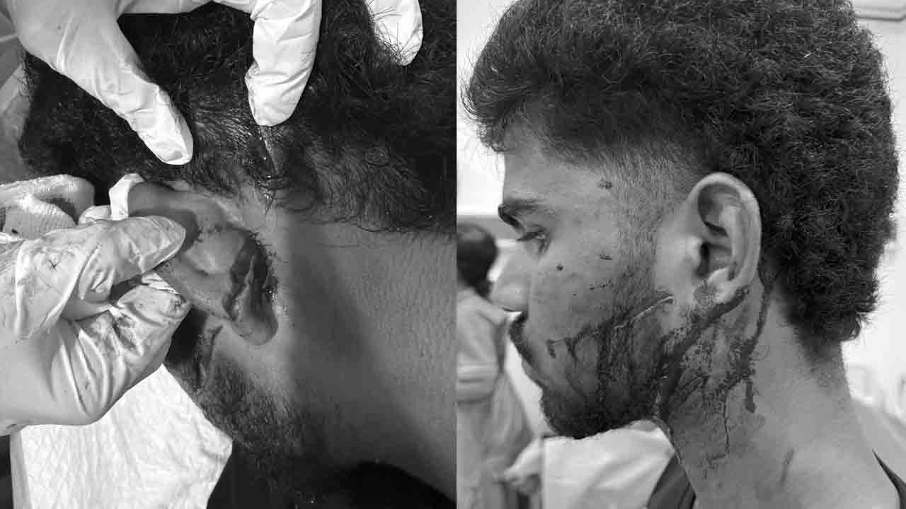 Attack | ఎక్సైజ్ ఎన్‌ఫోర్స్‌మెంట్‌ అధికారులమంటూ యువకులపై దాడి