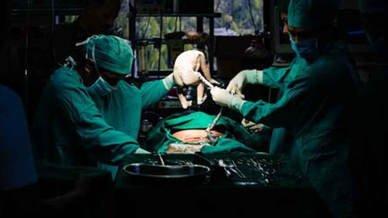 పైసల కోసం అమ్మ కడుపు కోత.. దేశంలో రోజురోజుకూ పెరుగుతున్న సిజేరియన్లు