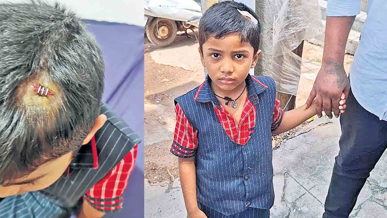 అల్లరి చేస్తున్నాడంటూ.. టిఫిన్‌ బాక్స్‌తో కొట్టిన టీచర్‌