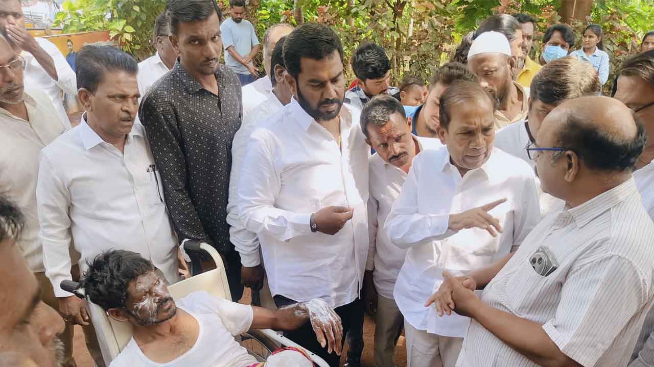 Gas leak | ఏడాకులపల్లిలో వంట గ్యాస్ లీకేజీ తో మంటలు .. ముగ్గురు వ్యక్తులకు గాయాలు