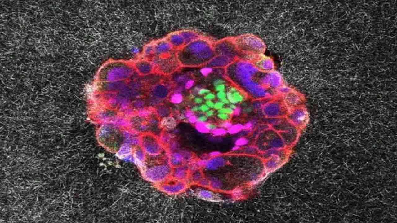 గర్భస్థ పిండ స్థాపన 3డి వీడియో చిత్రీకరణ