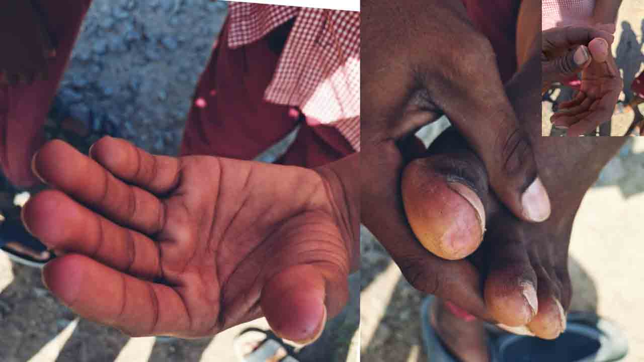 Harish Rao | ప్రచారం పేరుతో తమాషా చేయకు రేవంత్‌.. ప్రభుత్వ హాస్టళ్లలో విద్యార్థుల అవస్థలపై హరీశ్‌ రావు ఆగ్రహం