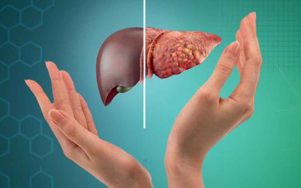 Liver Health | మీ లివ‌ర్ ఎల్ల‌ప్పుడూ శుభ్ర‌మై ఆరోగ్యంగా ఉండాలంటే.. వీటిని రోజూ తినండి..!
