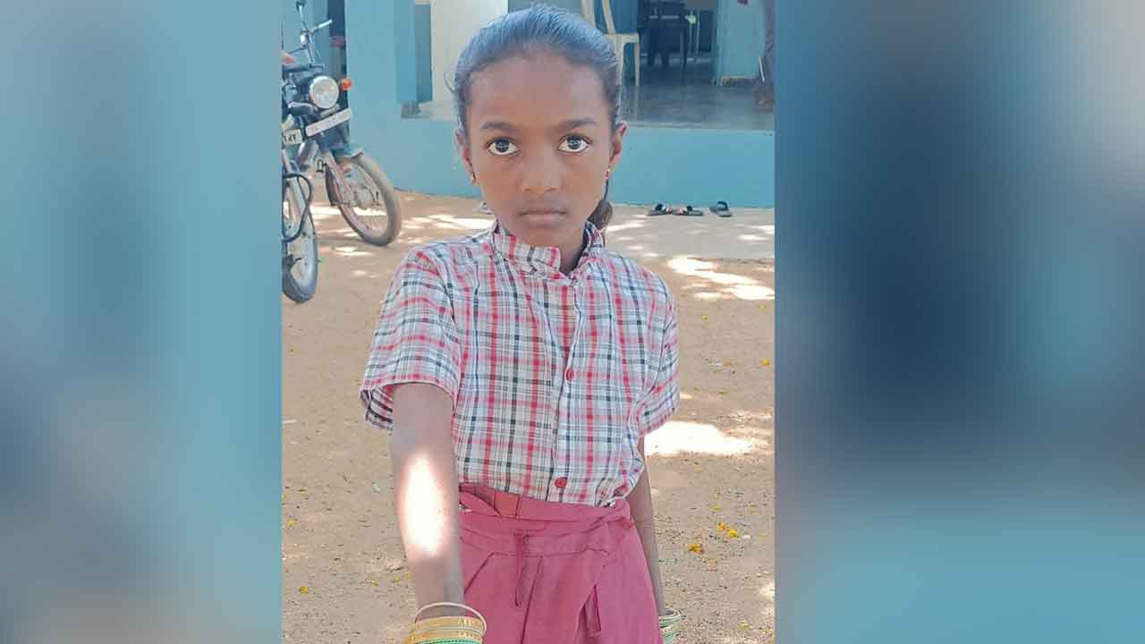 Monkey attack | కోతుల దాడిలో చిన్నారికి గాయాలు.. సిరిసిల్ల జిల్లాలో ఘటన