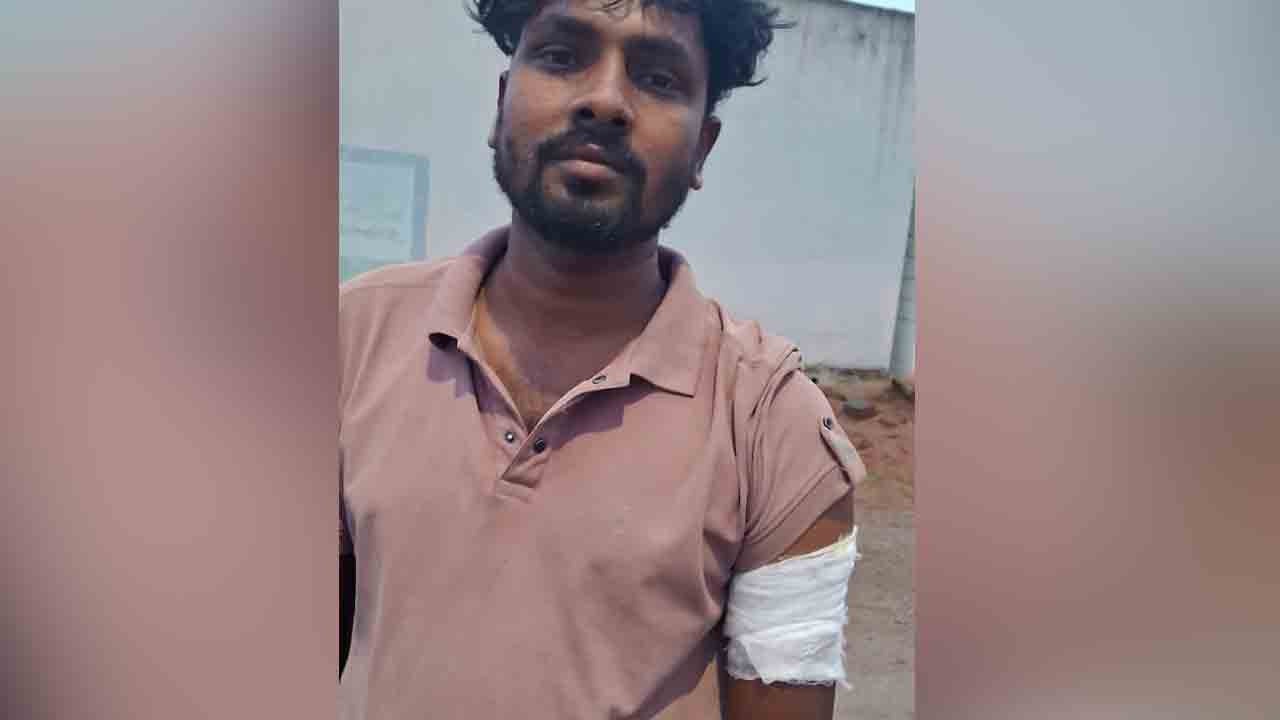 Rangareddy | బైక్‌పై వెళ్తున్న యువకుడిపై చిరుత దాడి.. భయాందోళనలో గ్రామస్తులు