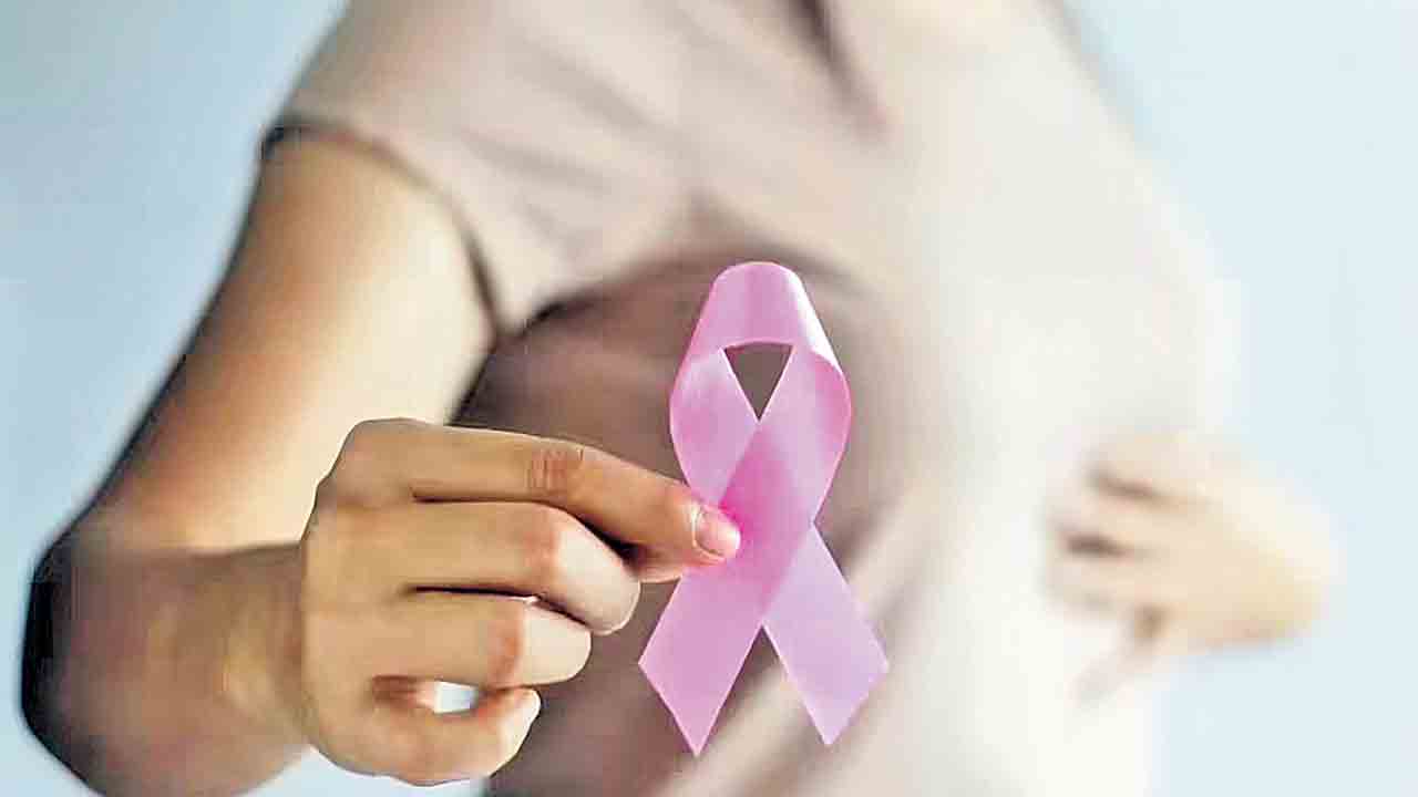 రొమ్ము క్యాన్సర్‌ కేసుల్లో హైదరాబాద్‌ టాప్‌