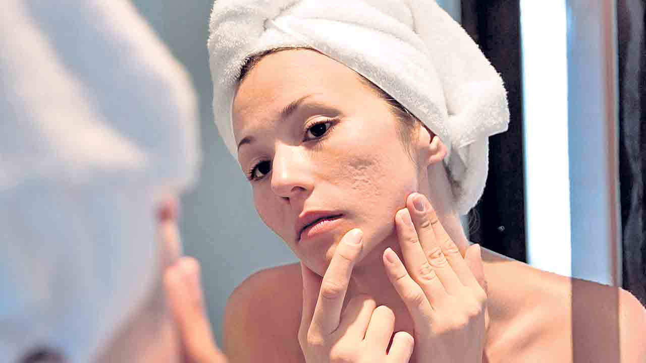 తేమతో సమస్య