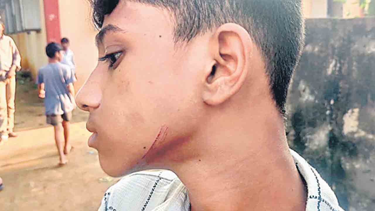 విద్యార్థులను చితకబాదిన వంట మాస్టర్