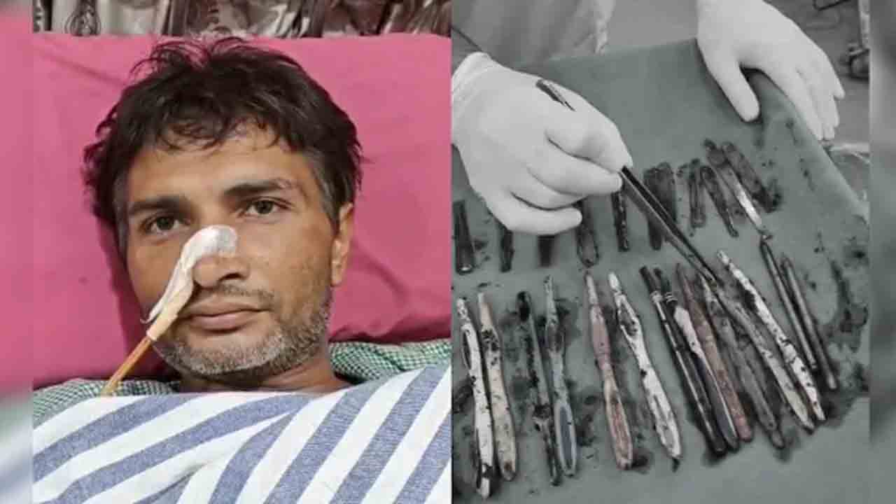 Man Eats Spoons, Tooth brushes | పునరావాస కేంద్రానికి పంపితే.. స్పూన్లు, బ్రష్‌లు    తినేందుకు బానిసయ్యాడు