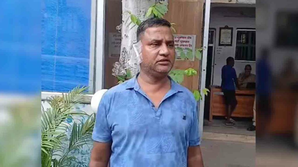 Woman Bites Off Husband's E