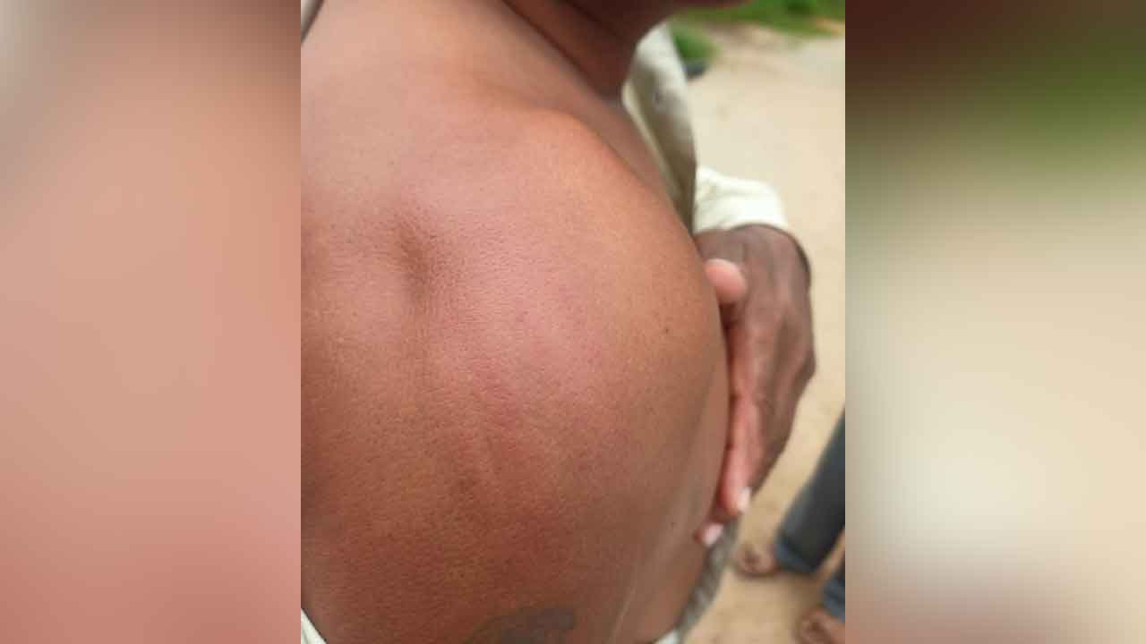 Veernapalli | లూజ్ వైర్లు సరిచేయకుంటే గ్రామంలోకి రావద్దు.. సెస్ సిబ్బందిపై గ్రామస్తుల దాడి