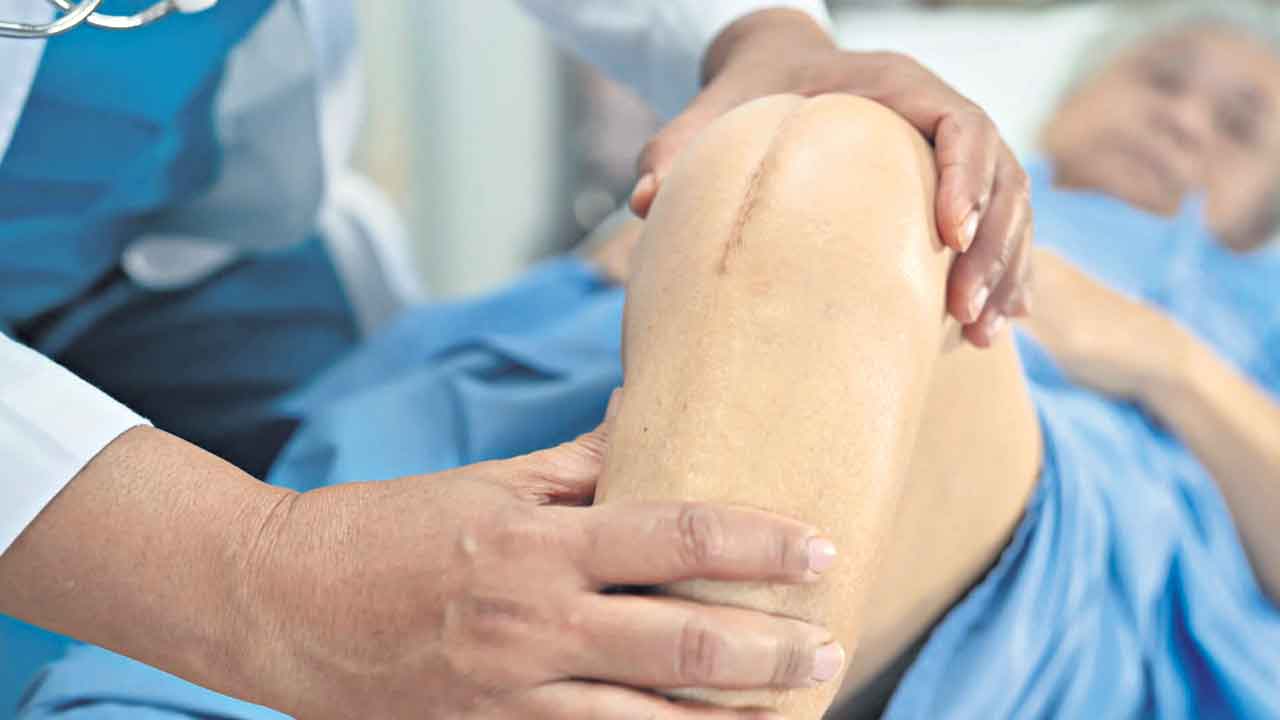 Knee Replacement 2