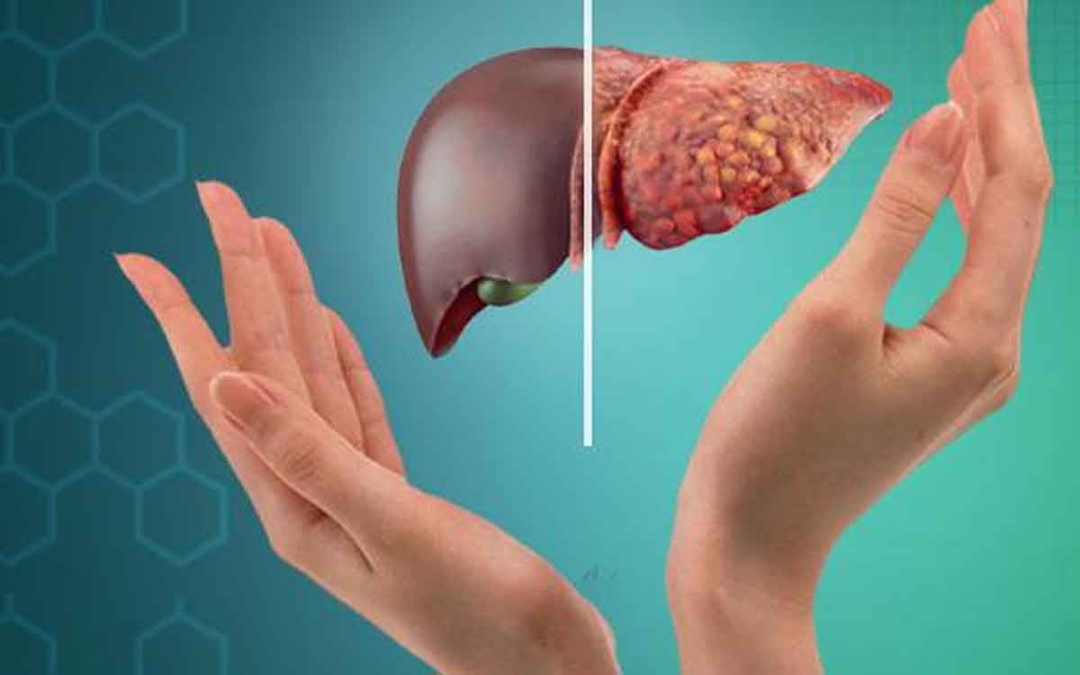 Liver Cleaning Foods | లివర్ను ఎప్పటికప్పుడు క్లీన్ చేసుకోవాల్సిందే.. లివర్ క్లీన్ అవ్వాలంటే వీటిని తీసుకోవాలి..!