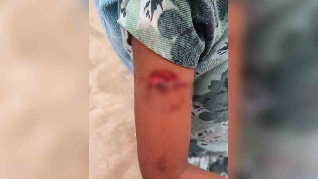 పెద్దపొర్లలో ఊర కుక్కల స్వైర విహారం