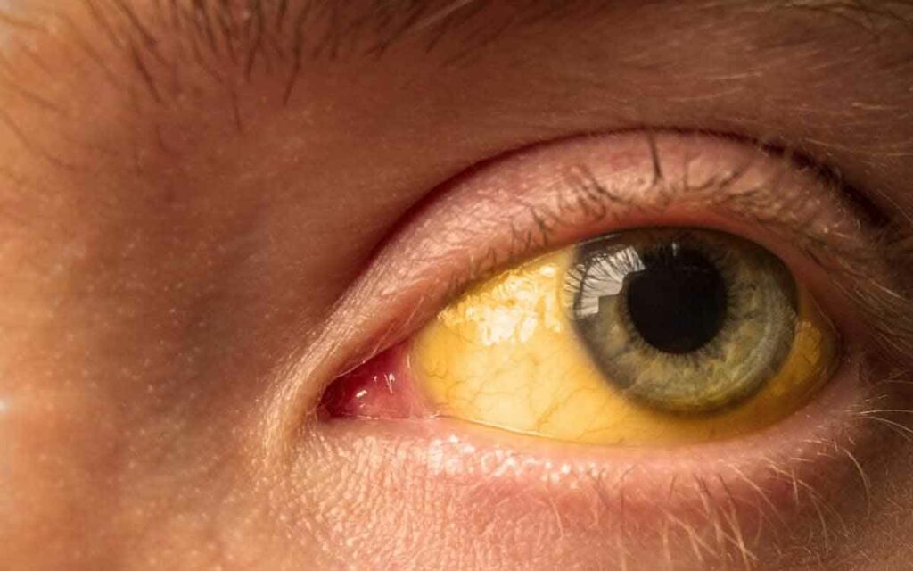 Yellow Eyes