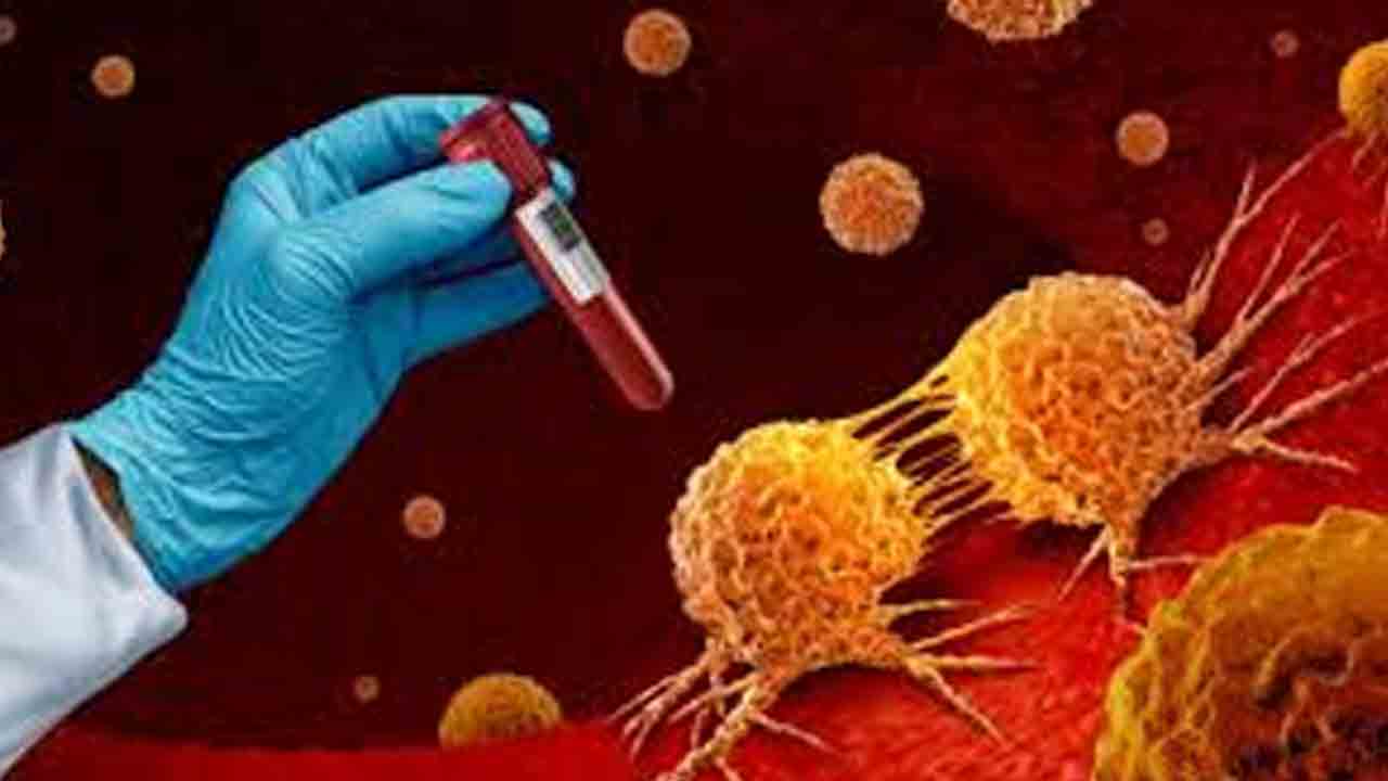 పదేండ్ల ముందే క్యాన్సర్‌ను పసిగట్టే రక్త పరీక్ష