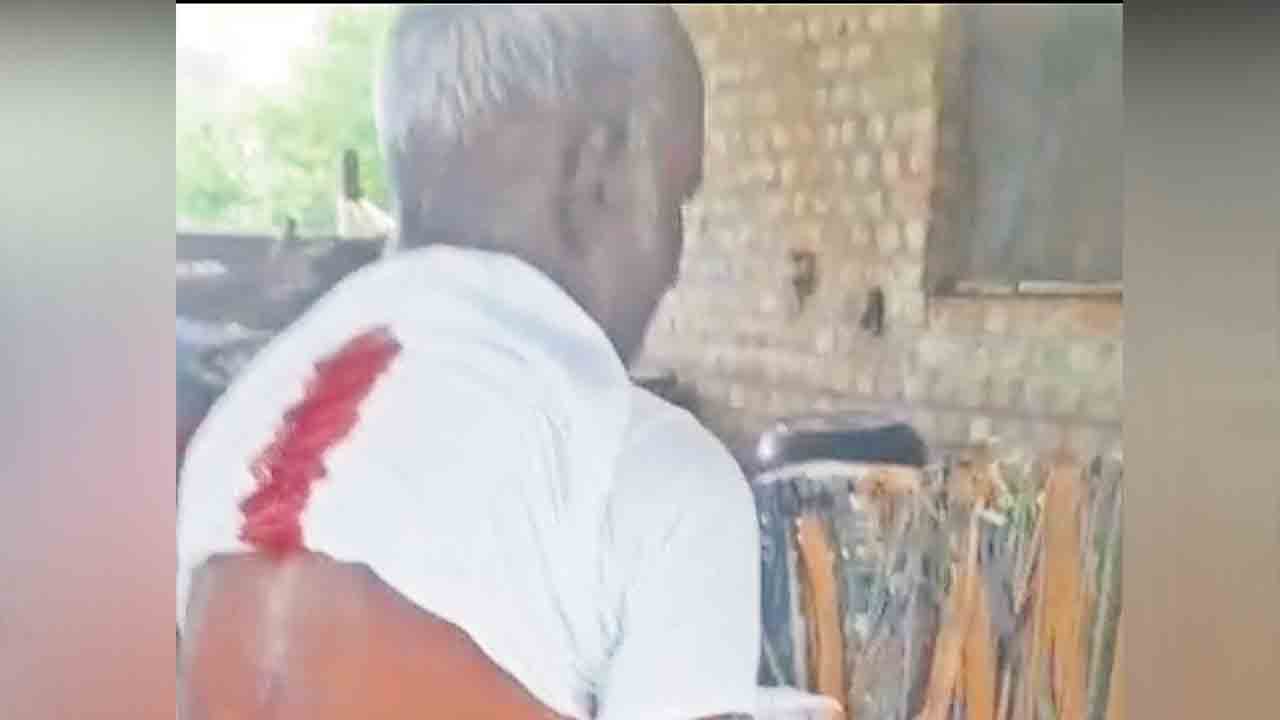 కోతుల దాడిలో వృద్ధుడికి గాయాలు