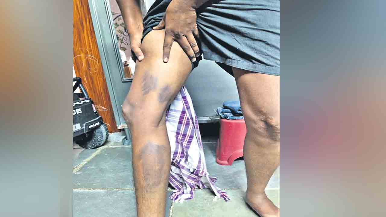 రాజీకి ఖాకీ యత్నం