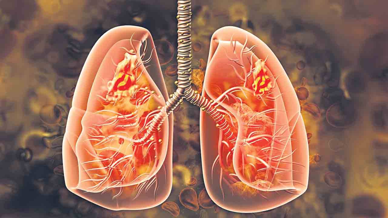 ఆడవాళ్లలోనూ ఆందోళనకరంగా!