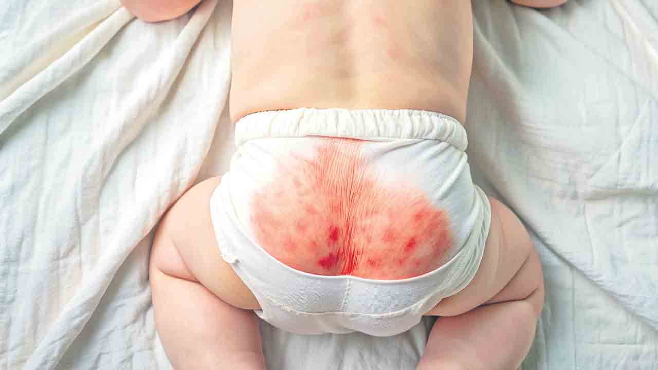 డైపర్‌.. డేంజర్‌!