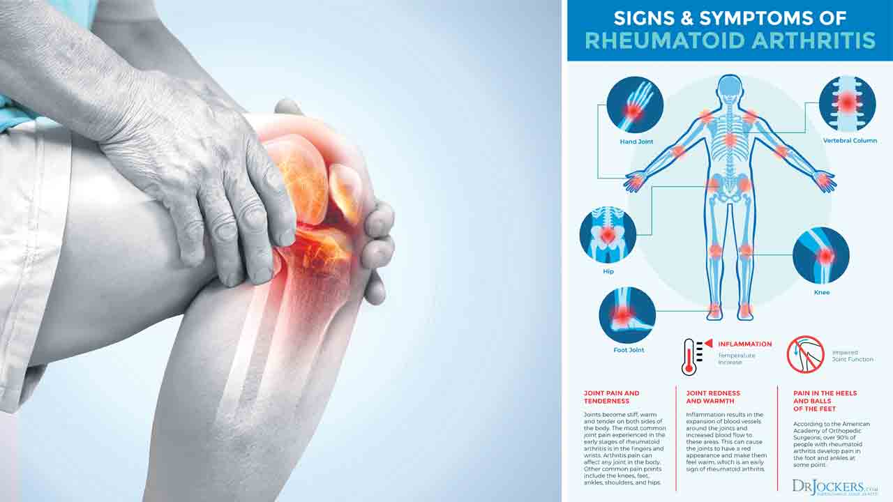 ఆర్థరైటిస్‌.. అలర్ట్‌