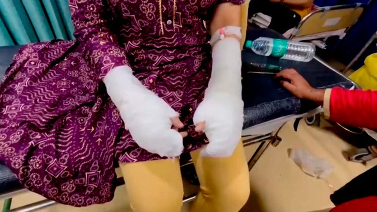 Acid Attack: యాసిడ్ దాడి కాదు.. అది టాయిలెట్ క్లీనర్.. ఢిల్లీ అటాక్ కేసులో ట్విస్ట్