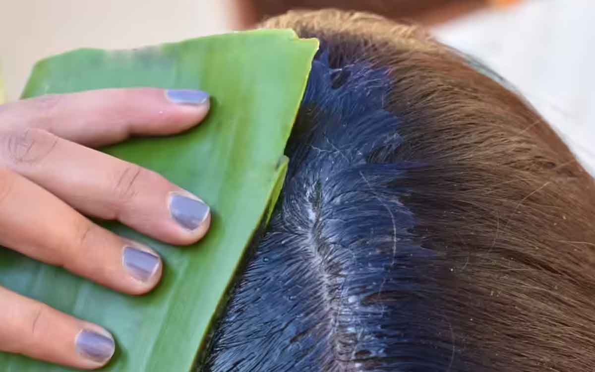 Aloe Vera For Hair | జుట్టు రాల‌డం ఇబ్బంది పెడుతుందా..? అన్ని ర‌కాల జుట్టు స‌మ‌స్య‌ల‌కు క‌ల‌బంద‌ను ఇలా వాడండి..!