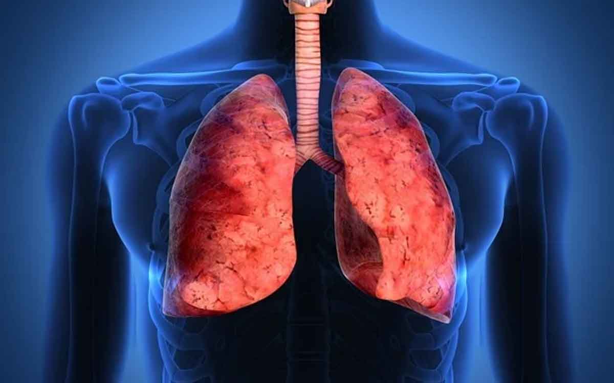 Asthma | ఆస్త‌మా ఉందా.. అయితే ఈ చిట్కాల‌ను పాటించండి.. ఉప‌శ‌మనం ల‌భిస్తుంది..!