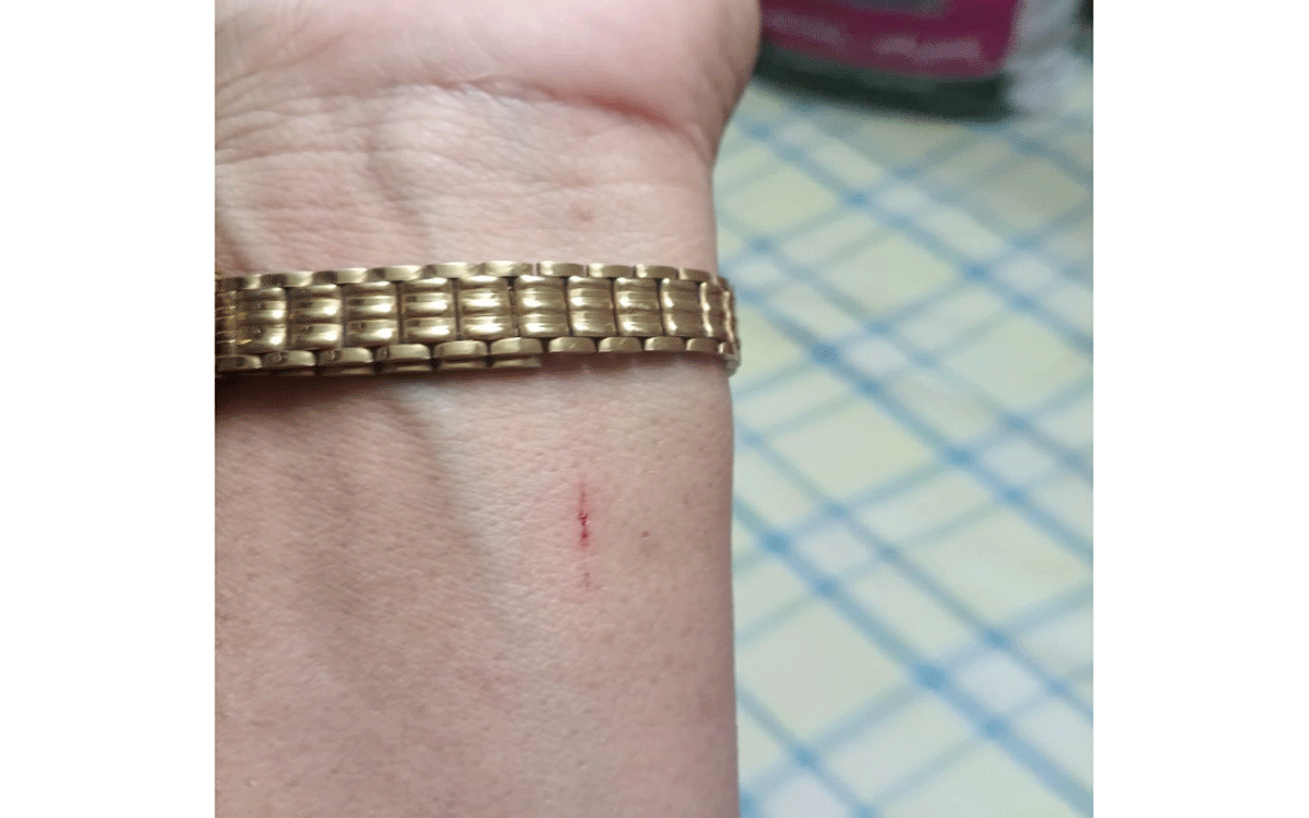 Bibinagar : మహిళపై బీబీన‌గ‌ర్‌ ఎయిమ్స్ సిబ్బంది దాడి